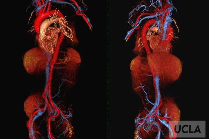 Cardiovascular system, including veins and arteries.