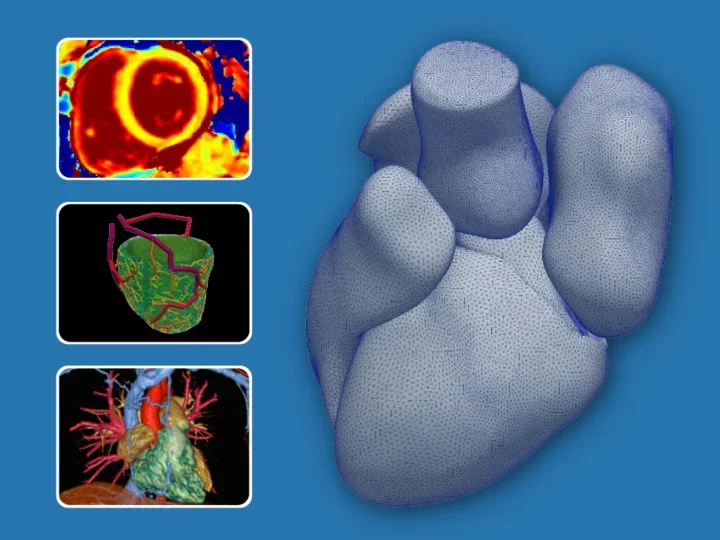 There are several cardiac images and a cardiac mesh