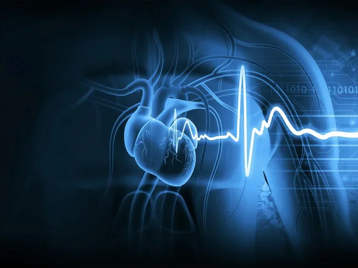 cardiovascular imaging